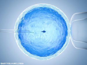 妇科专家